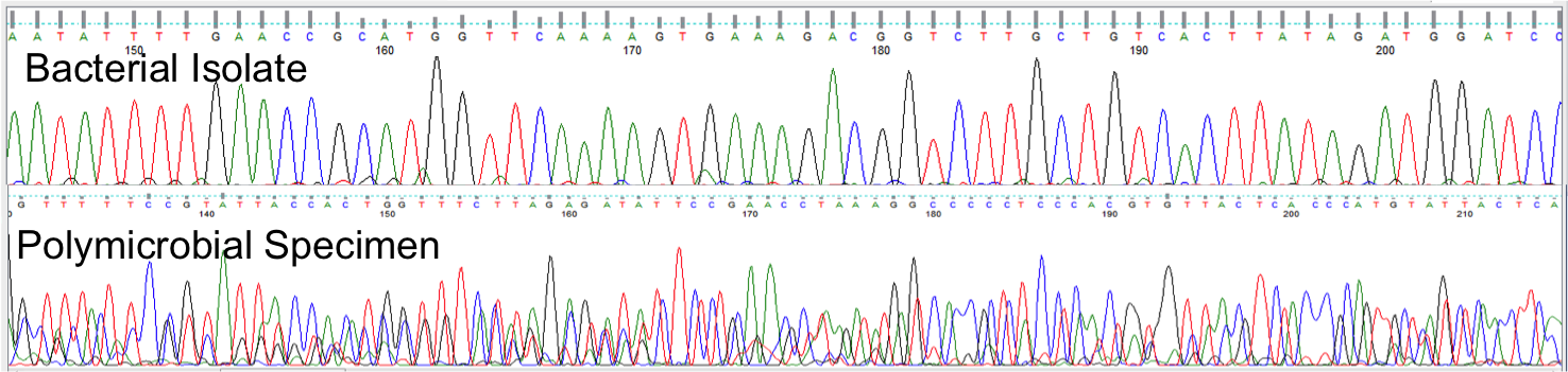 Centre-for-Molecular-Biology-Research-Bacterial-identification-using-16s-Gene-sequencing-